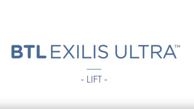 BTL Exilis Ultra - Testimonial Patient - Joe