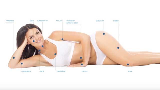 Exilis Ultra 360 - Product Presentation